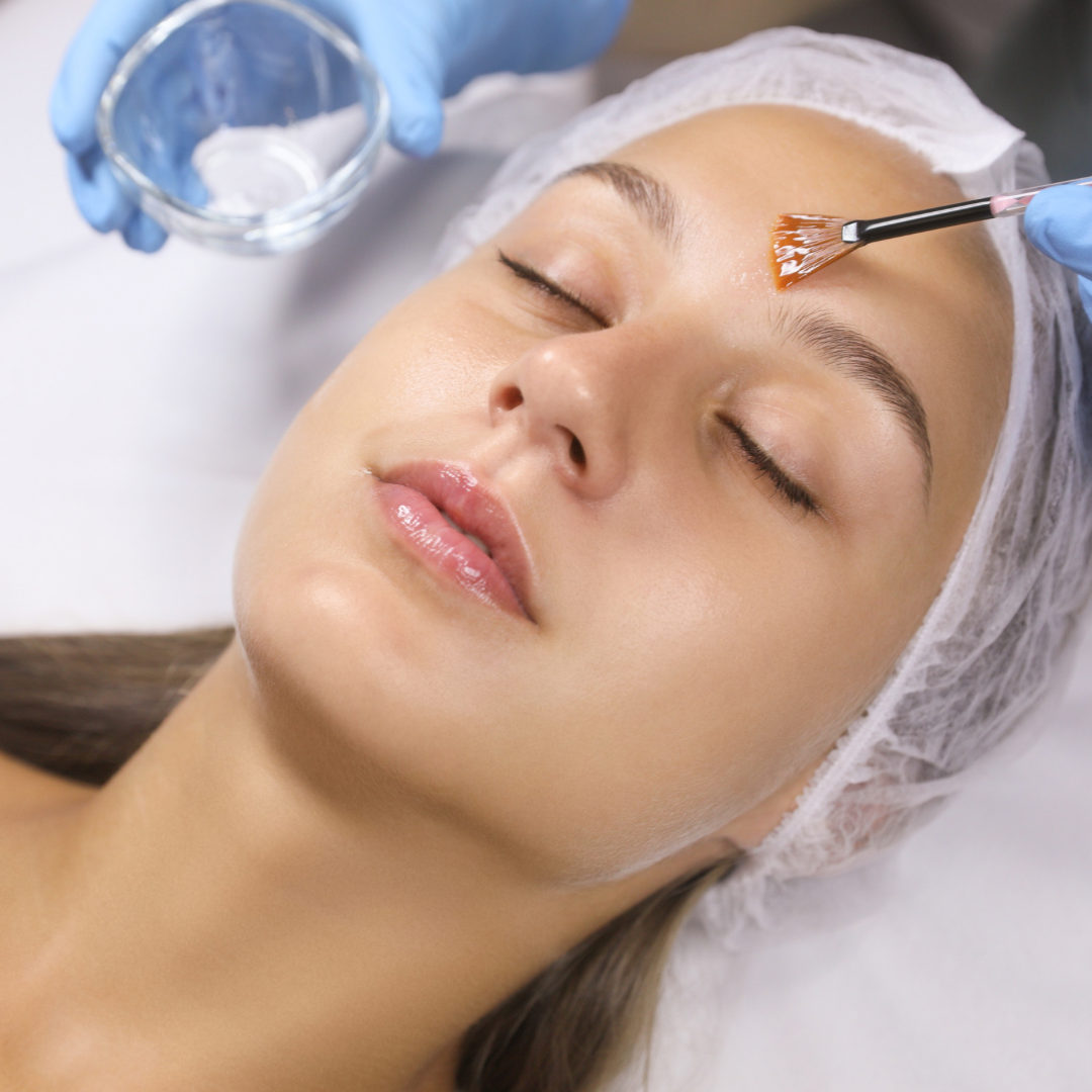 21/11/23 Chemical Peel Course